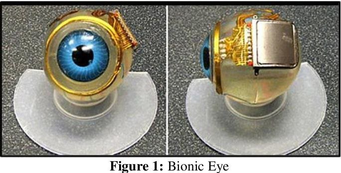 Ojo biónico